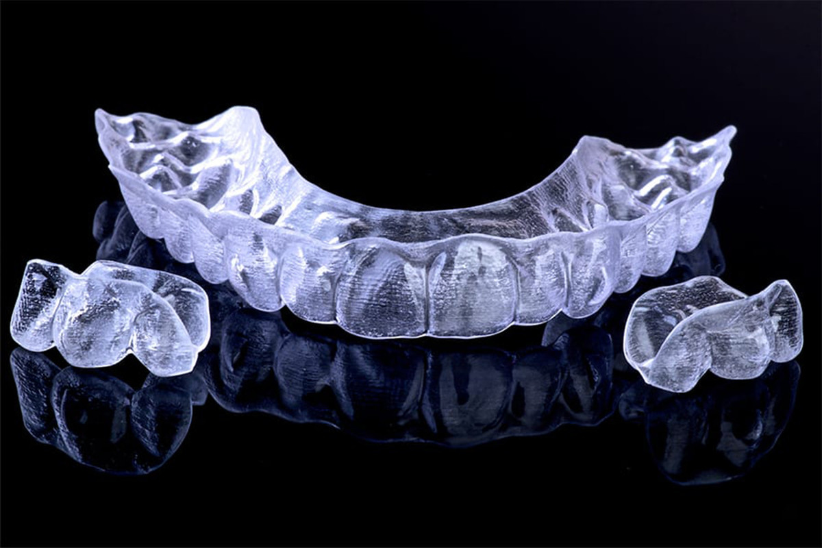 ortodontski-aparati/clear-aligner